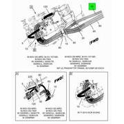 Figure 17JVP